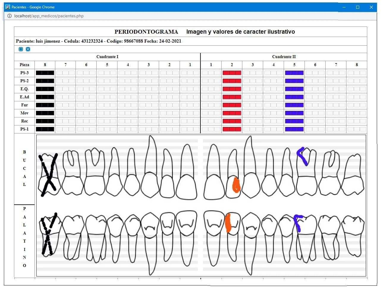 Diseno de Periodontogramas