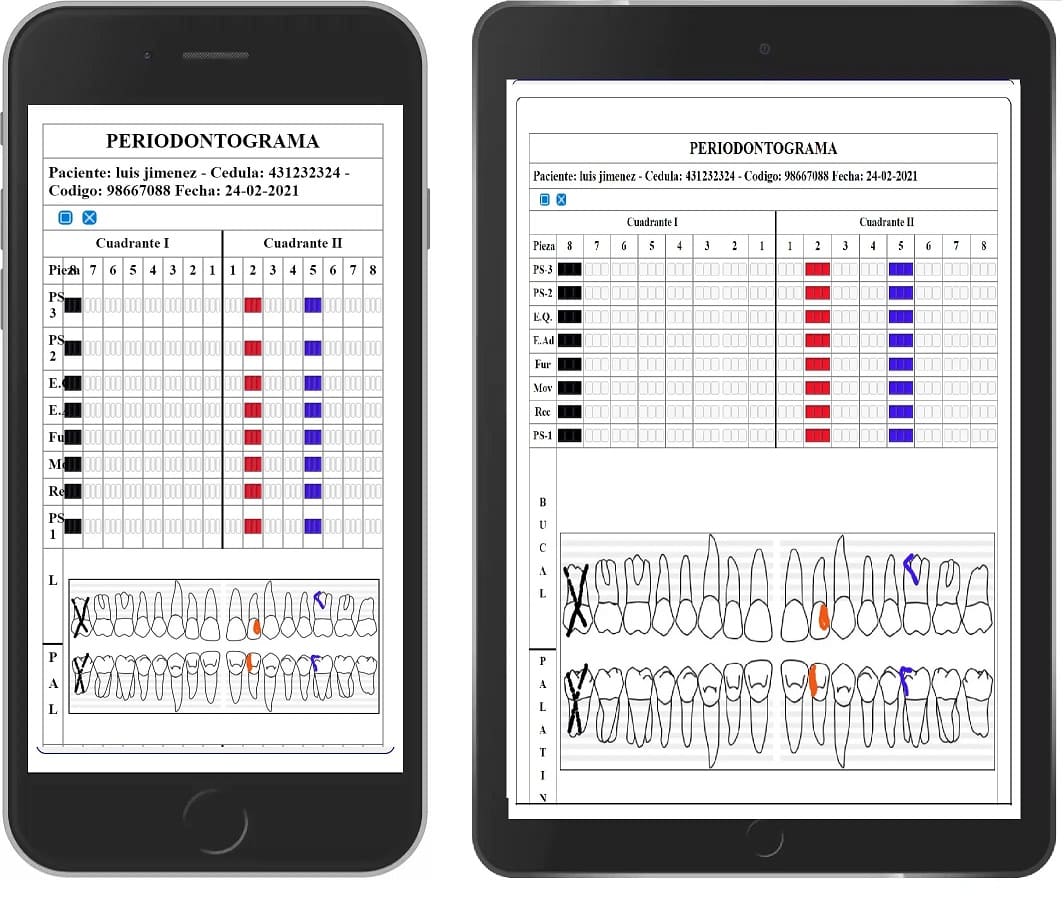 Periodontogramas